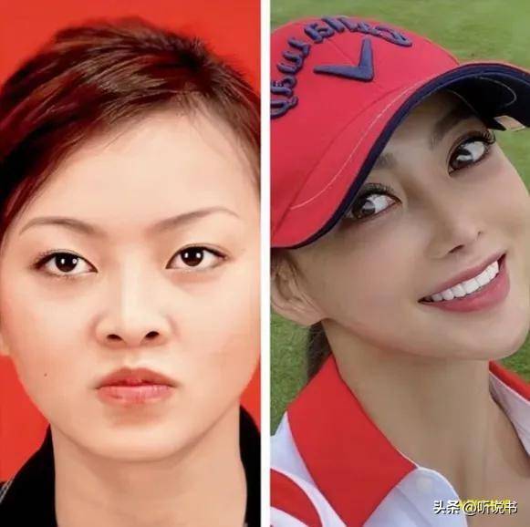 整容成瘾整到面目全非越来越像芭比娃娃J9真人游戏第一品牌香港知名男星前妻(图2) 整容成瘾整到面目全非越来越像芭比娃娃J9真人游戏第一品牌香港知名男星前妻(图2)